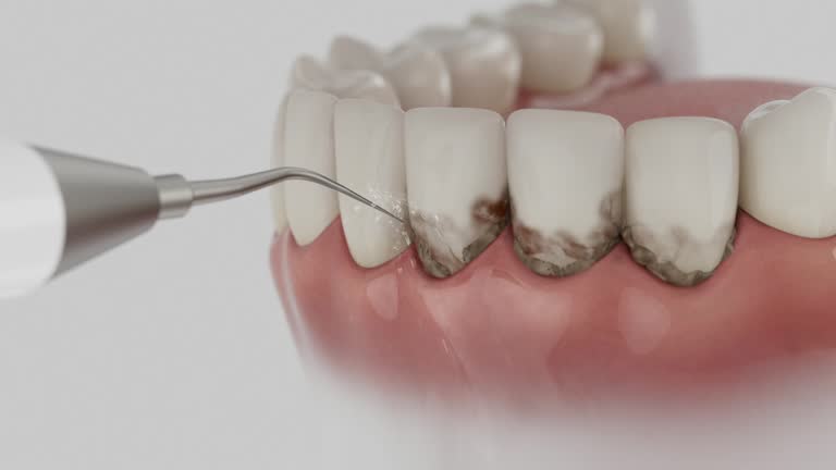 Trusted Wisdom Tooth Removal service in La Vergne, TN - Dentist Open Now
